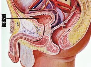 慢性前列腺炎的癥狀及其影響，慢性前列腺炎的癥狀及影響概述